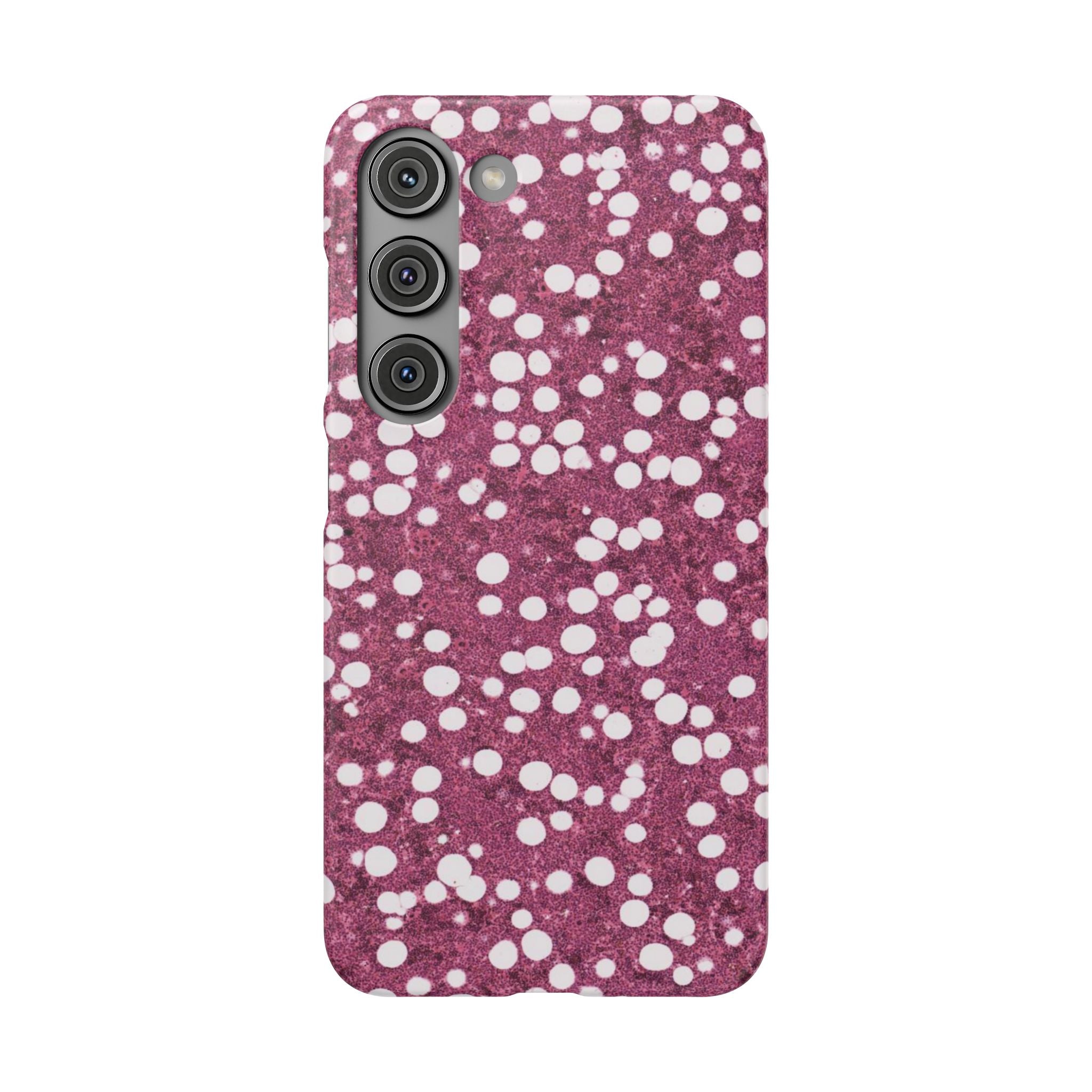 Slim Case Myelolipom