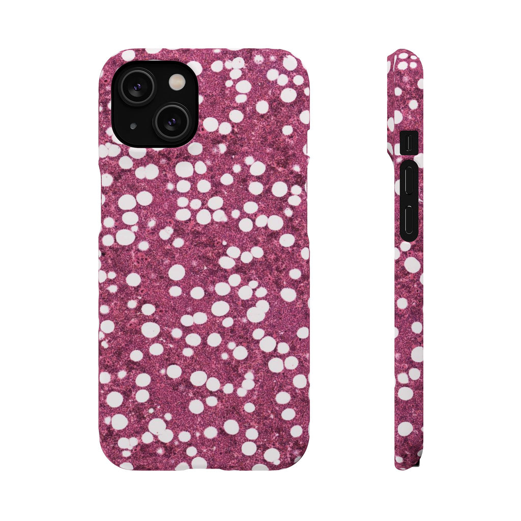 Slim Case Myelolipom