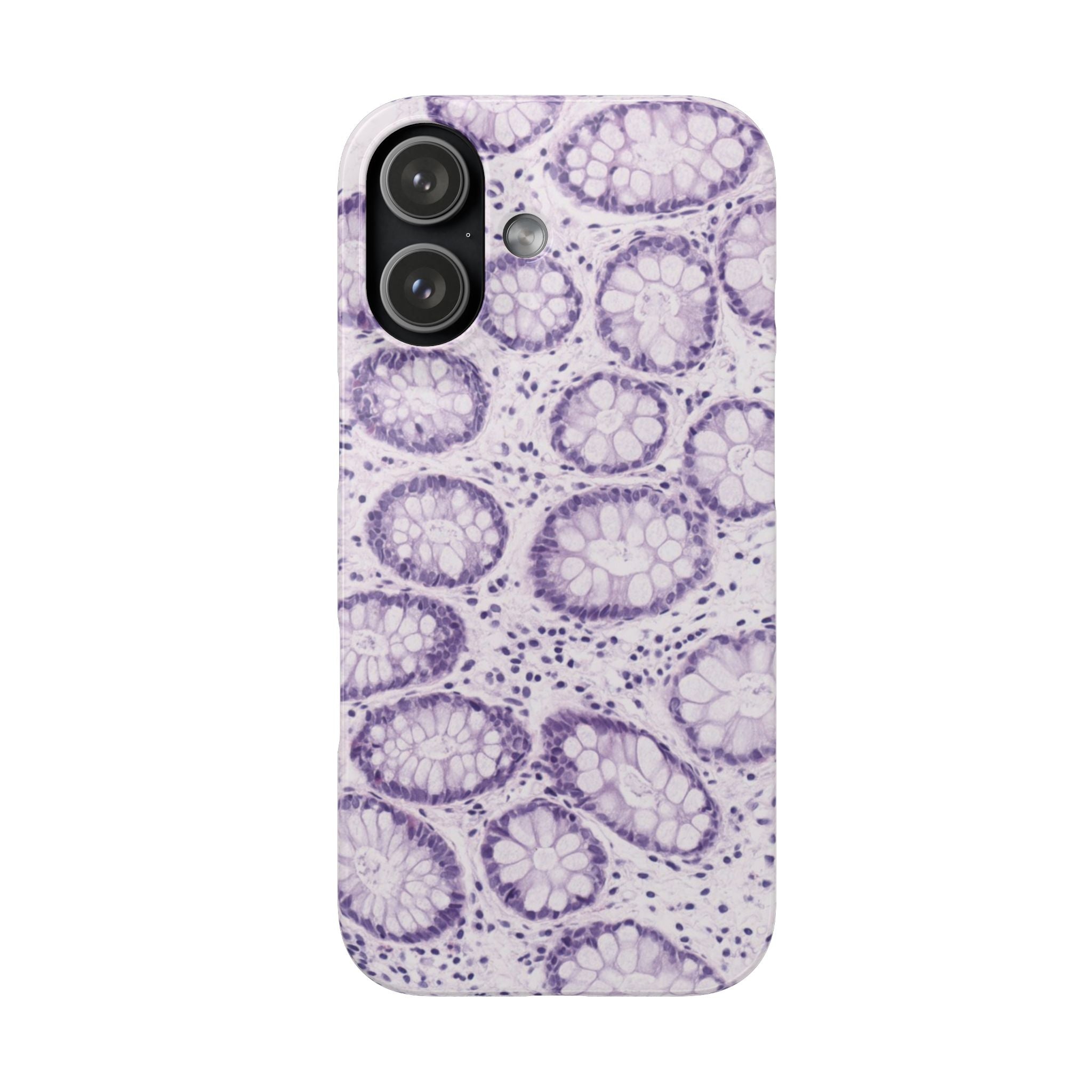 Slim Case Kolon