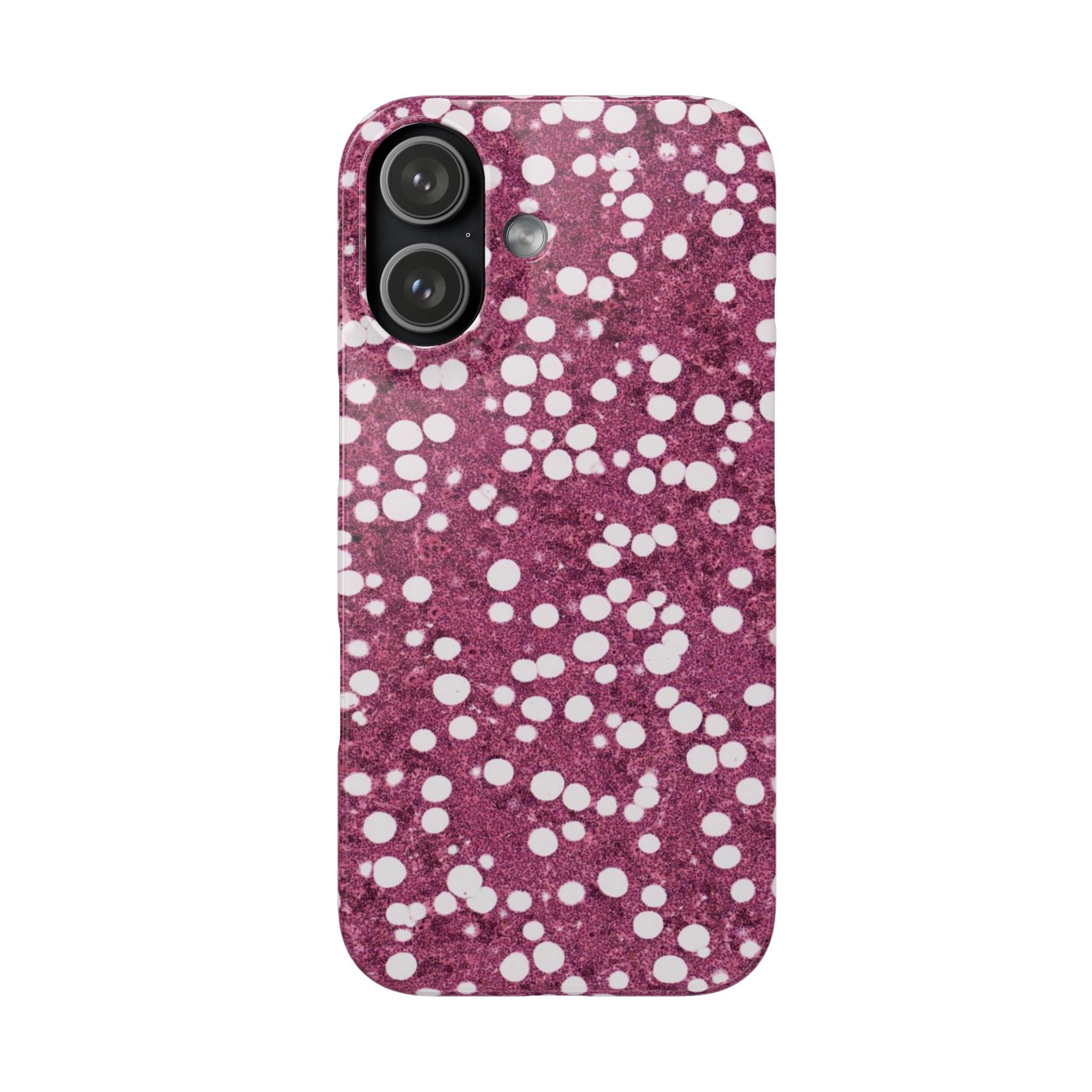 Slim Case Myelolipom
