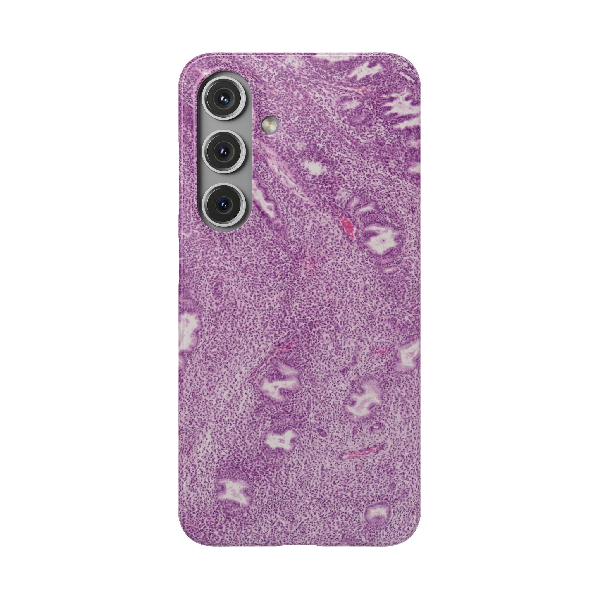 Slim Case Endometrium
