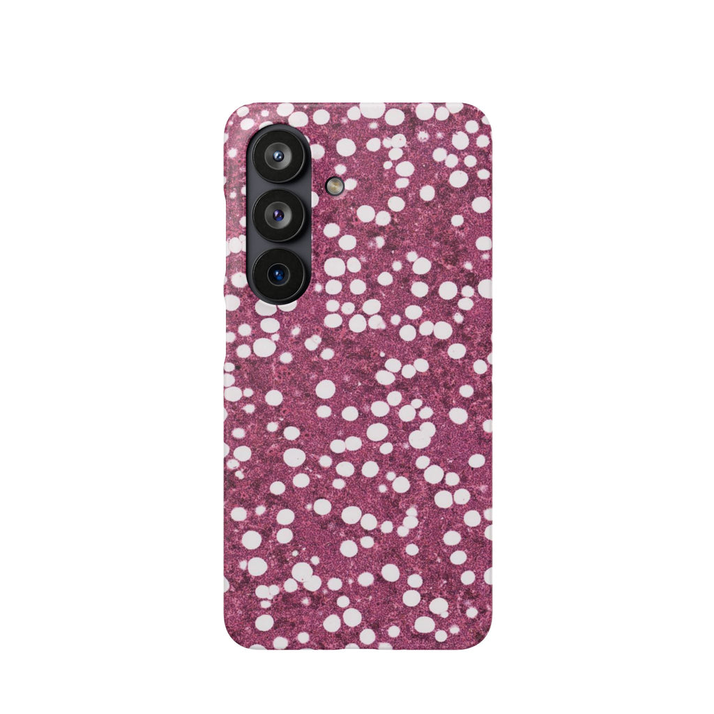 Slim Case Myelolipom