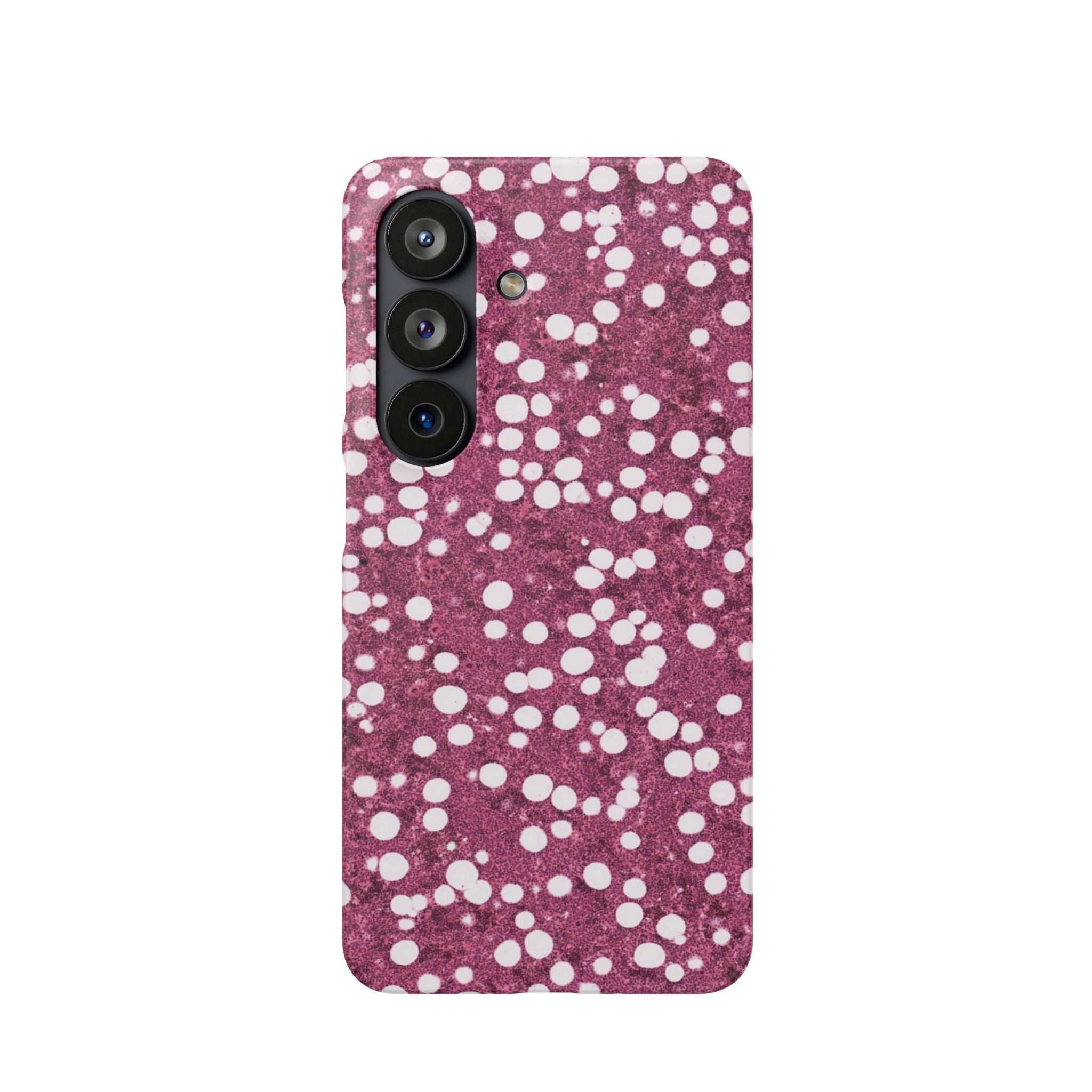Slim Case Myelolipom