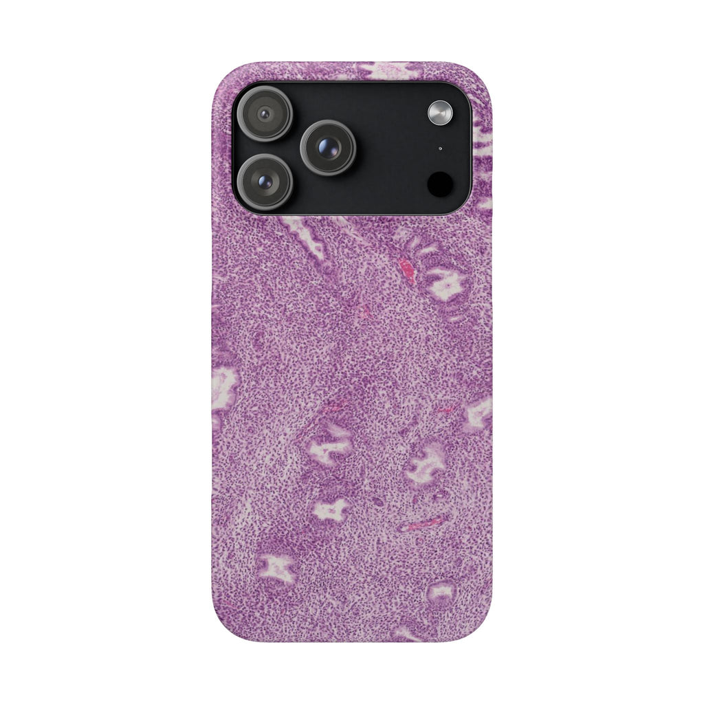 Slim Case Endometrium
