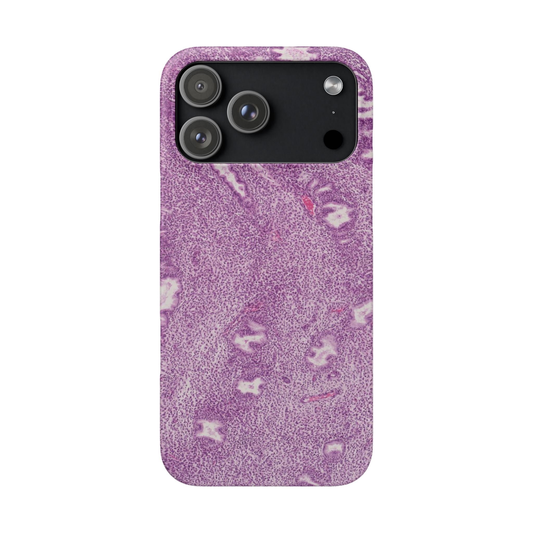 Slim Case Endometrium