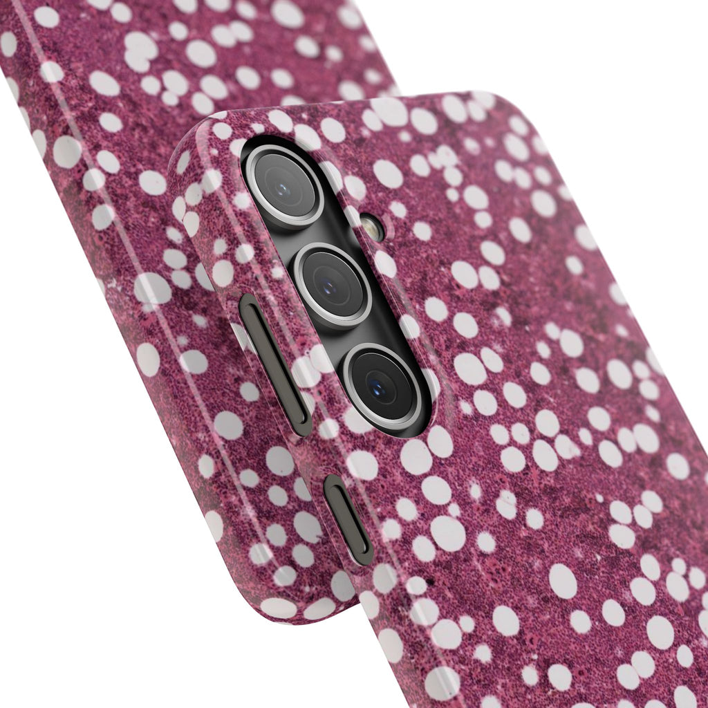 Slim Case Myelolipom