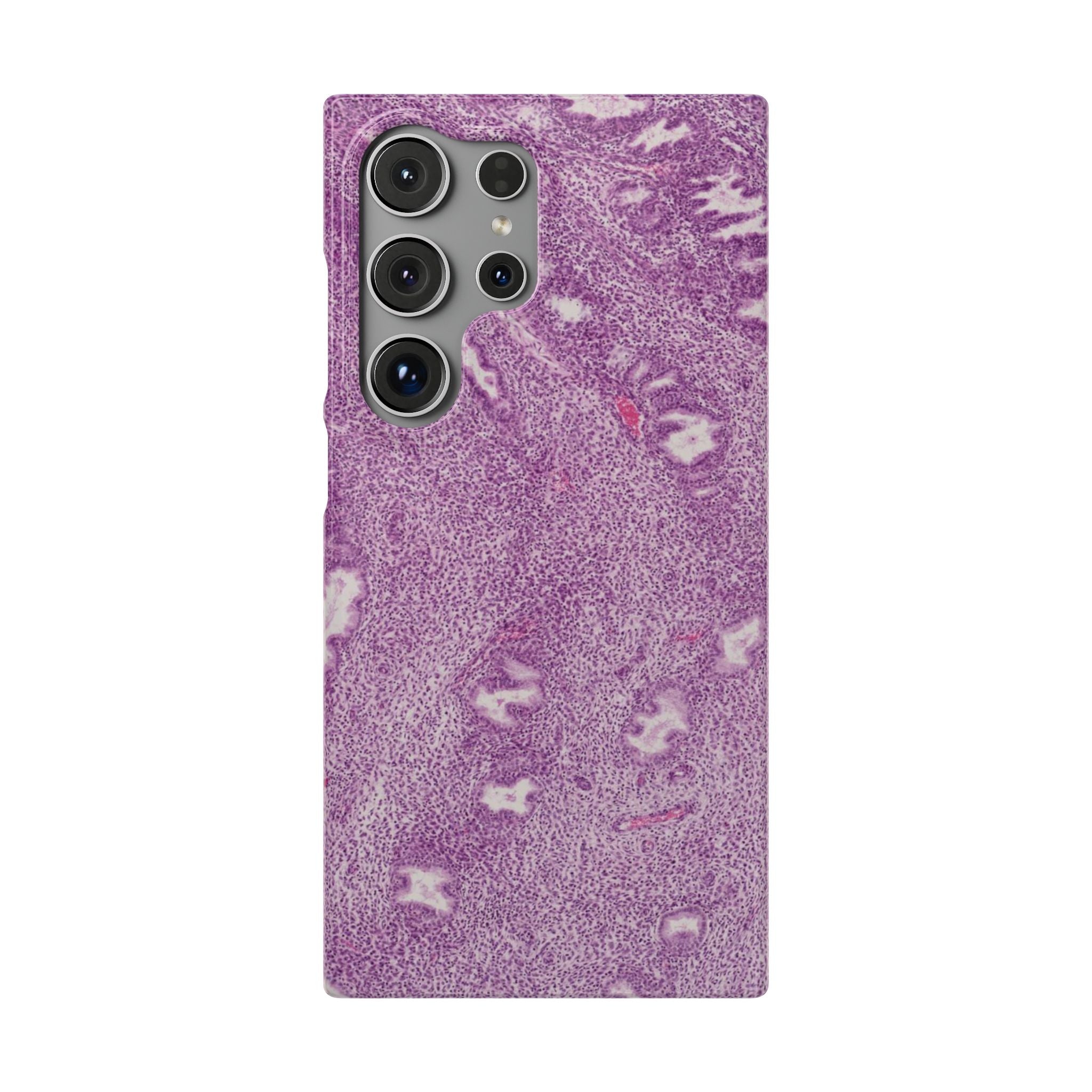 Slim Case Endometrium