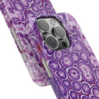 Slim Case Peutz-Jeghers Polyp