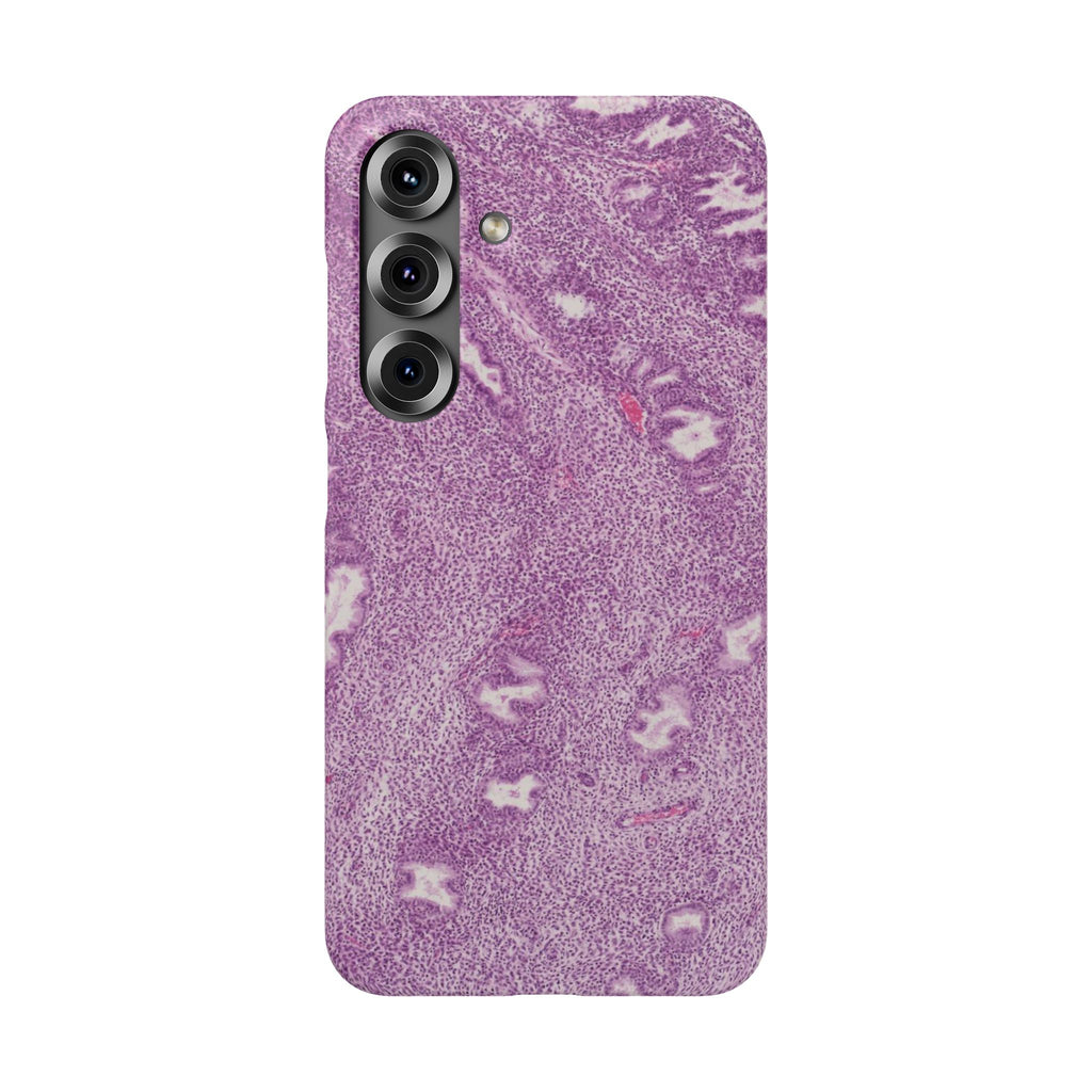 Slim Case Endometrium