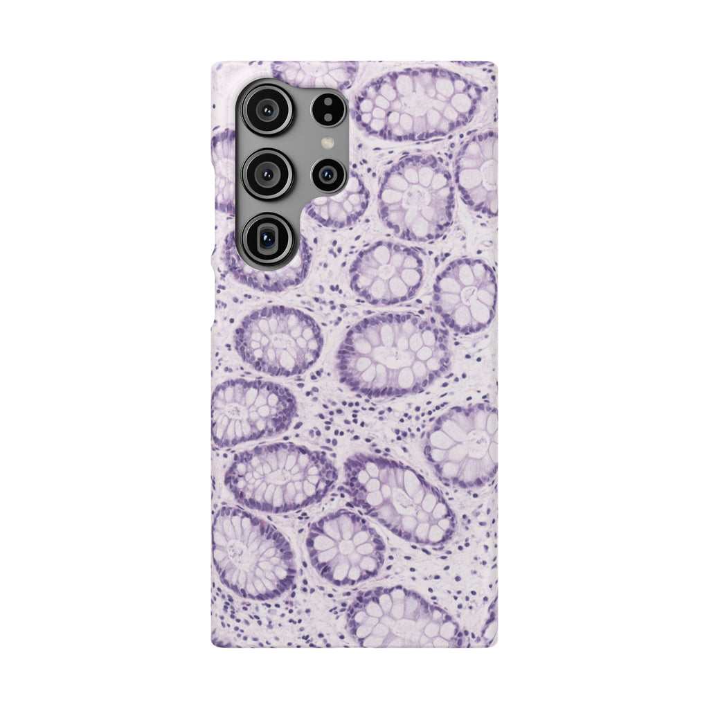 Slim Case Kolon