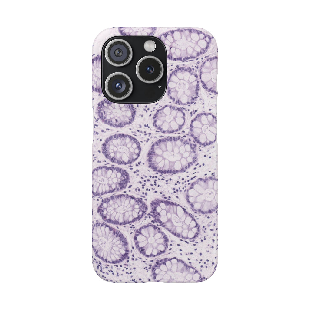 Slim Case Kolon