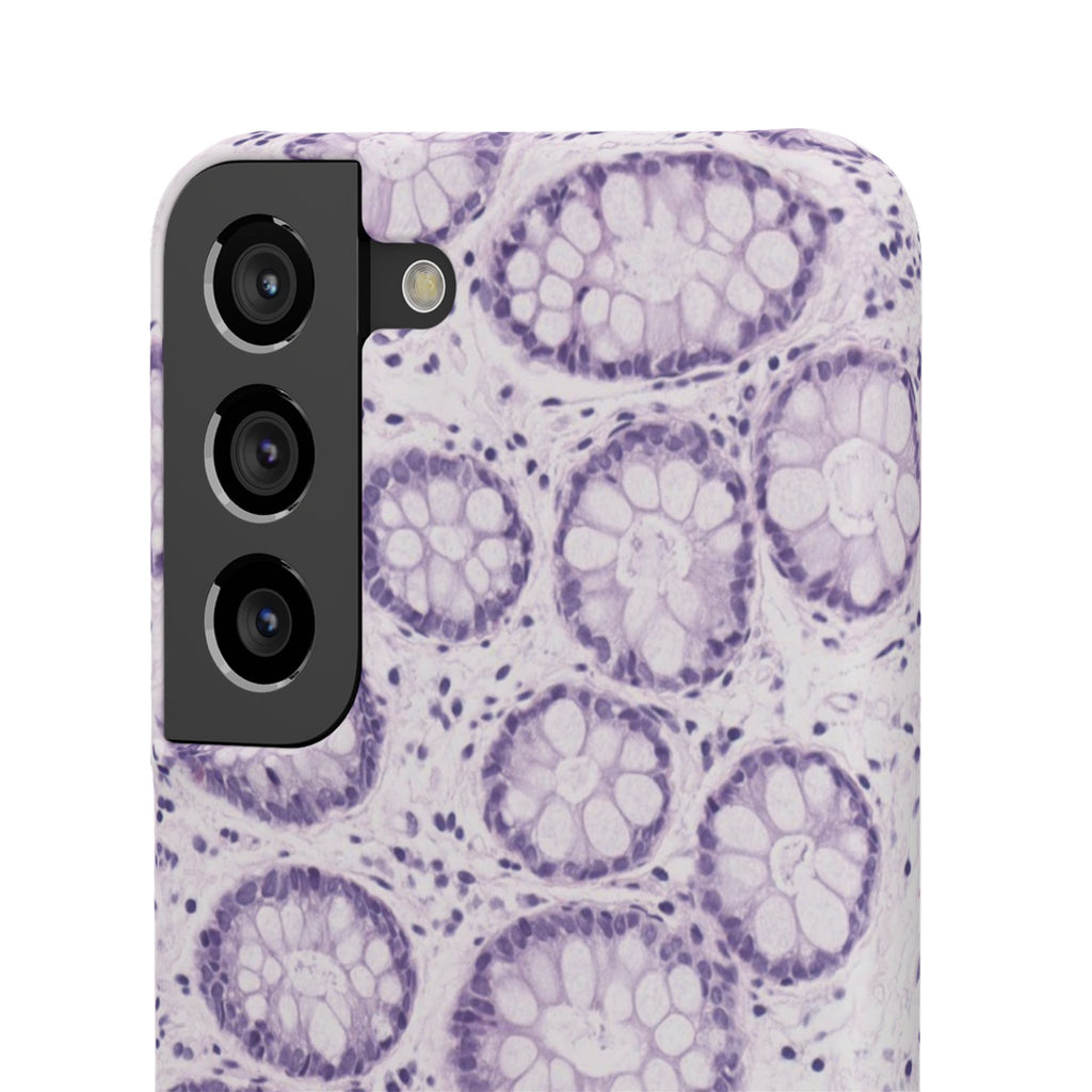 Slim Case Kolon