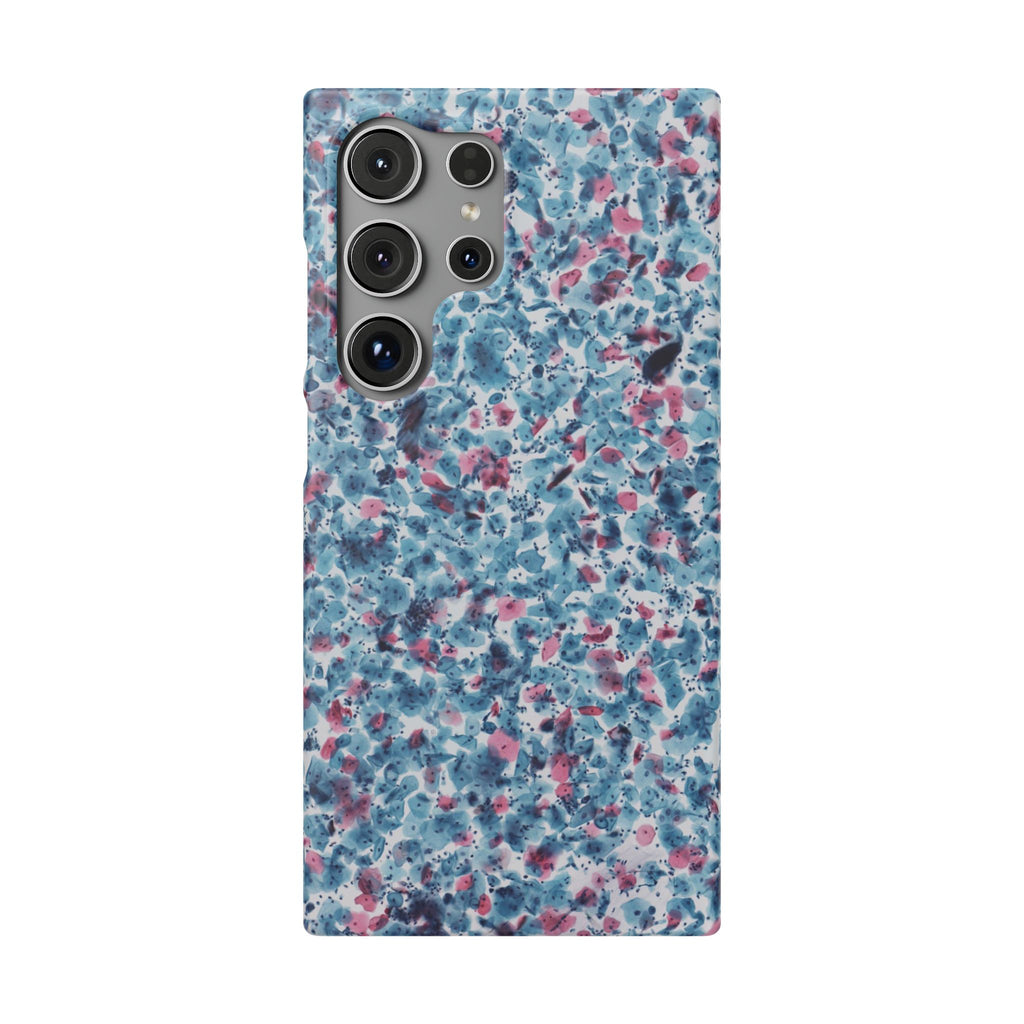 Slim Case PAP
