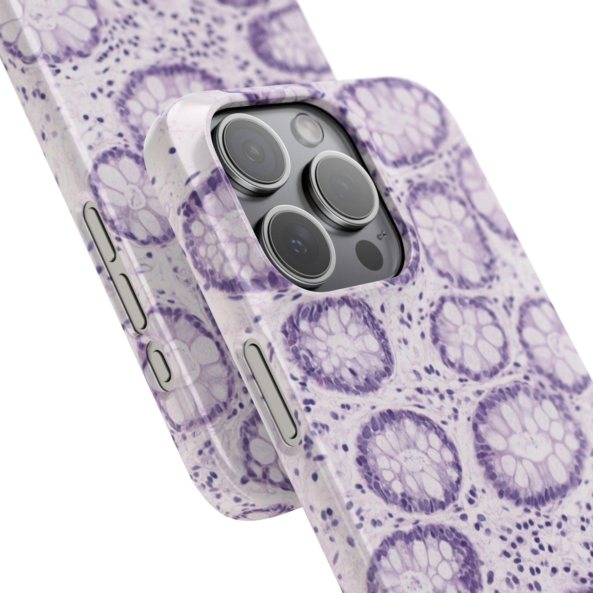 Slim Case Kolon