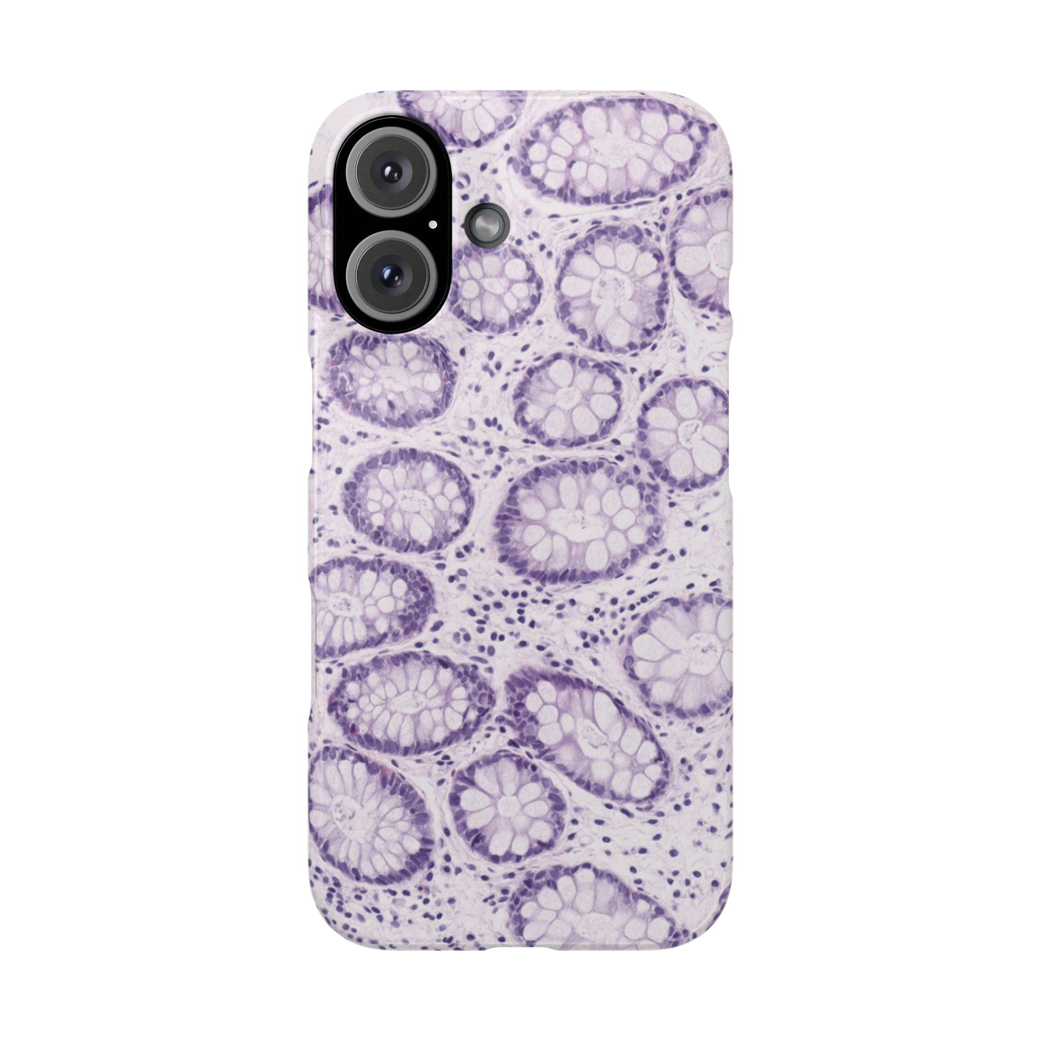 Slim Case Kolon