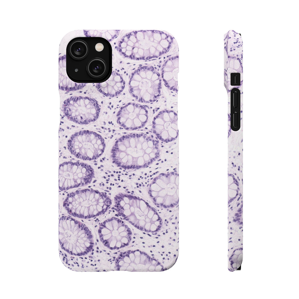 Slim Case Kolon