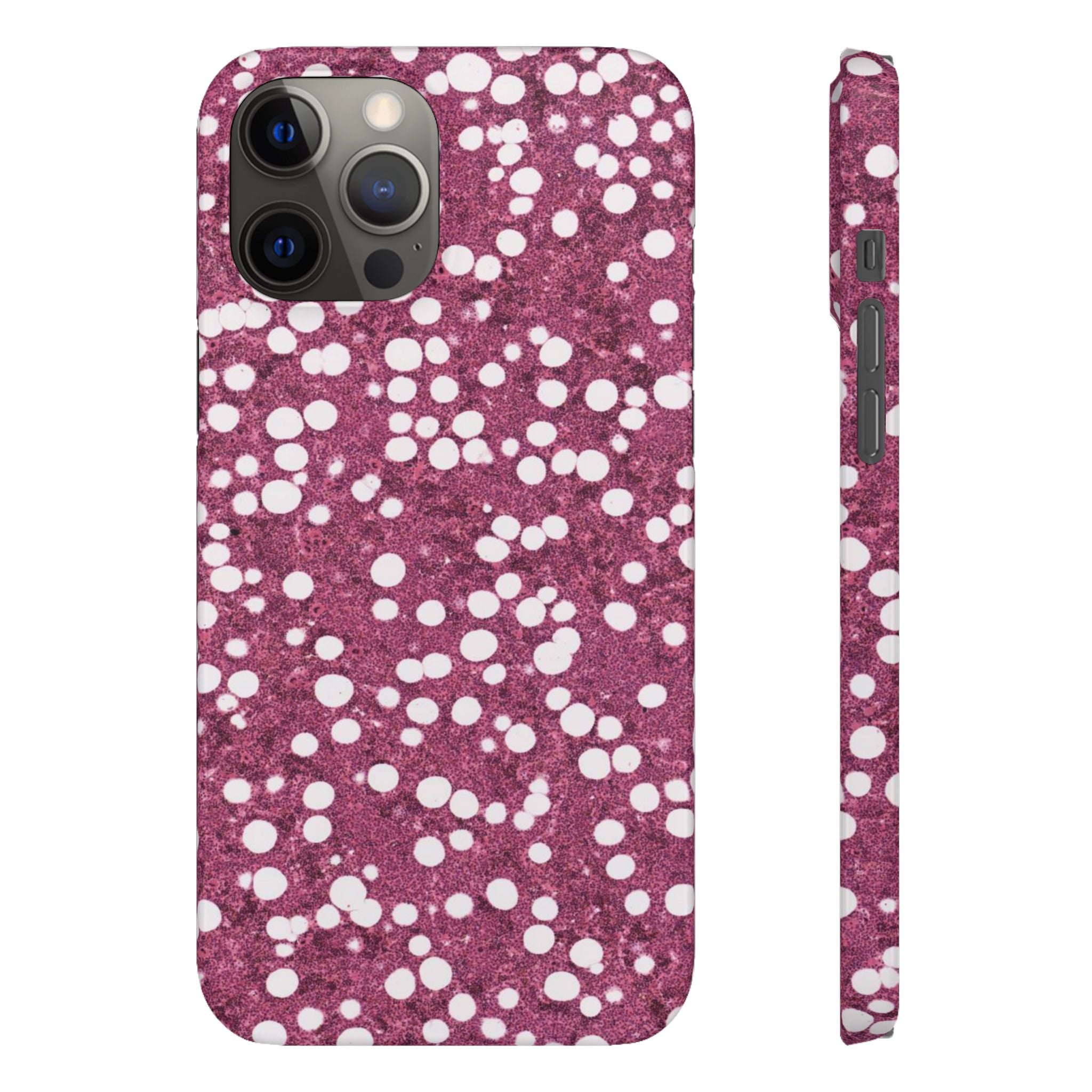 Slim Case Myelolipom
