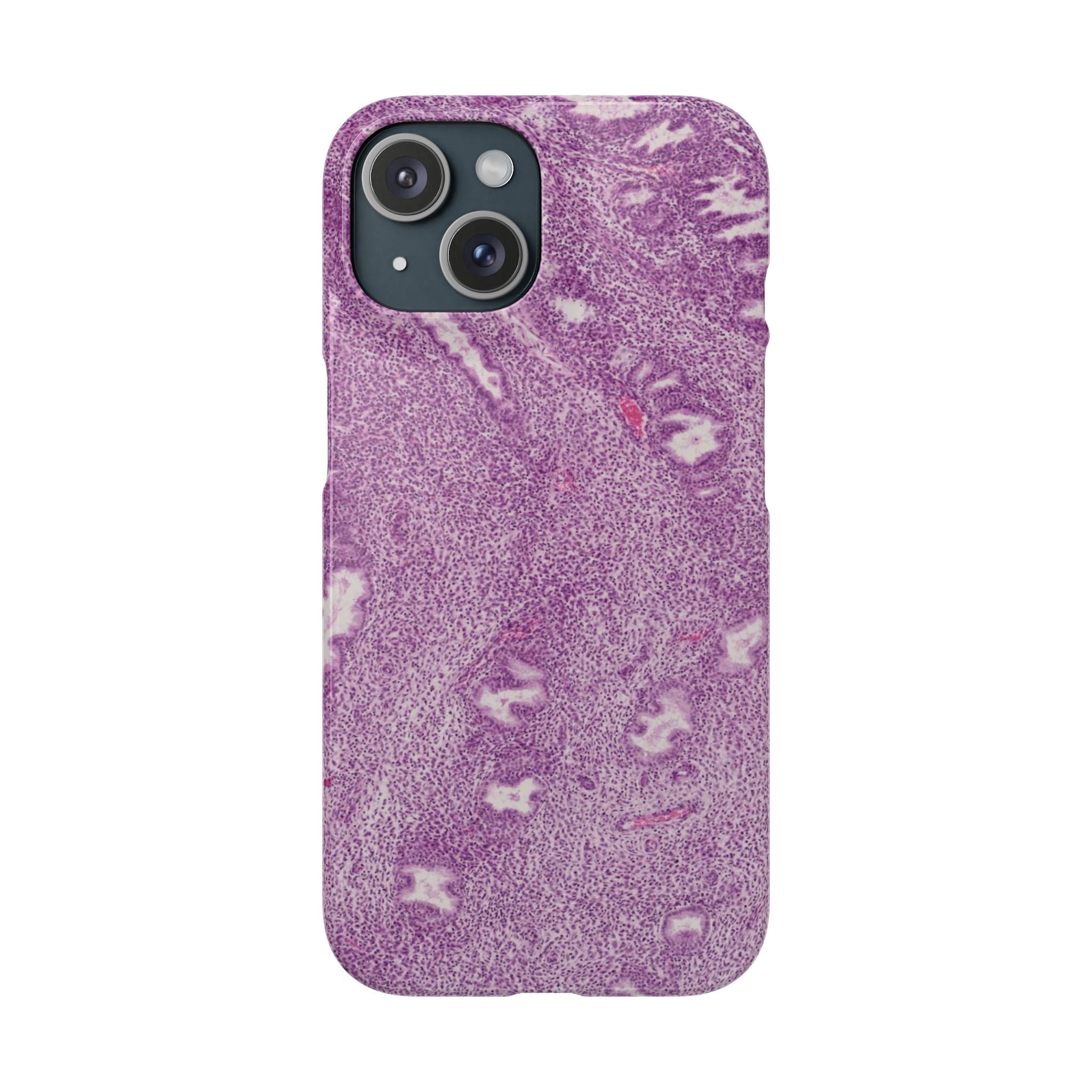Slim Case Endometrium