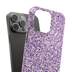 Slim Case Paraganglion