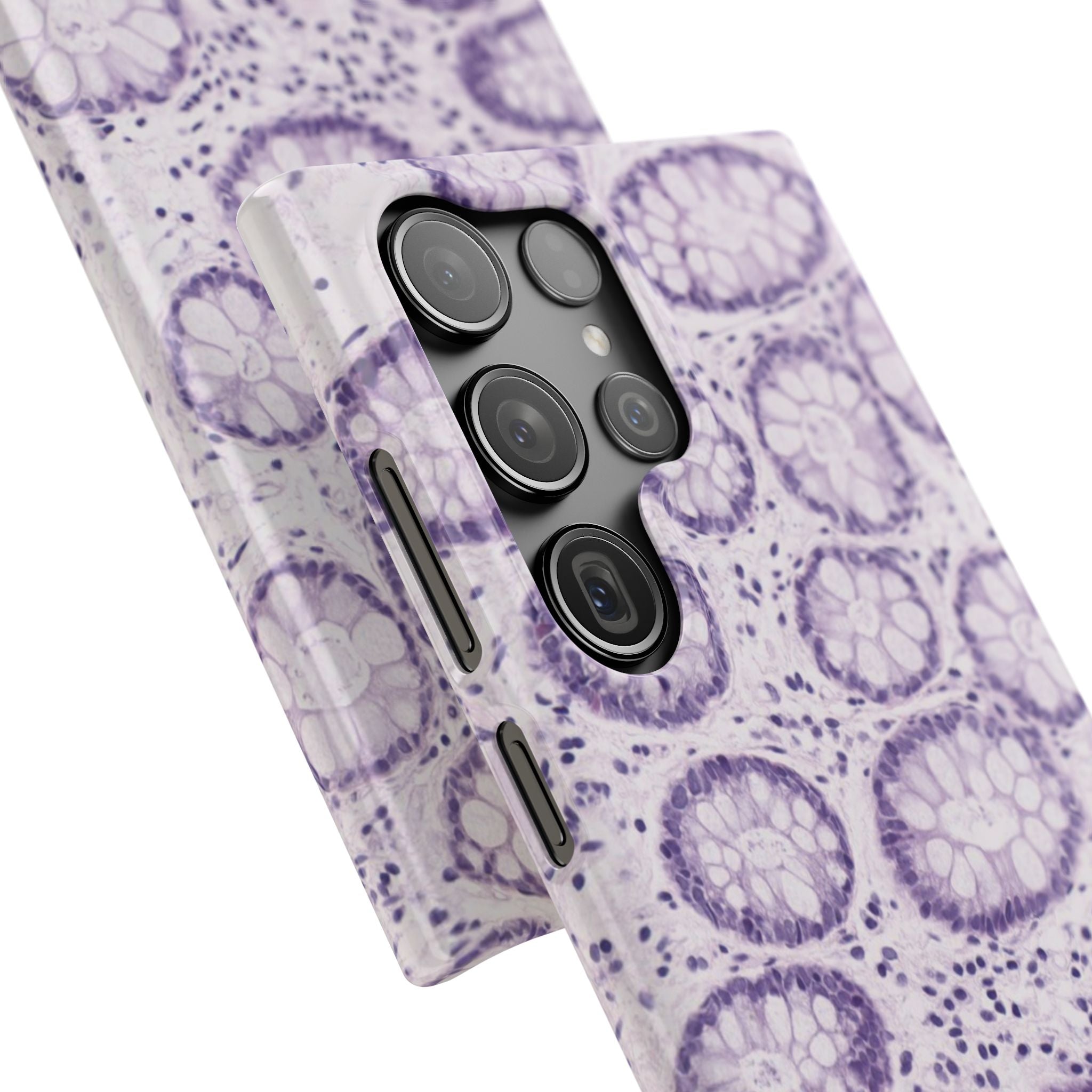Slim Case Kolon