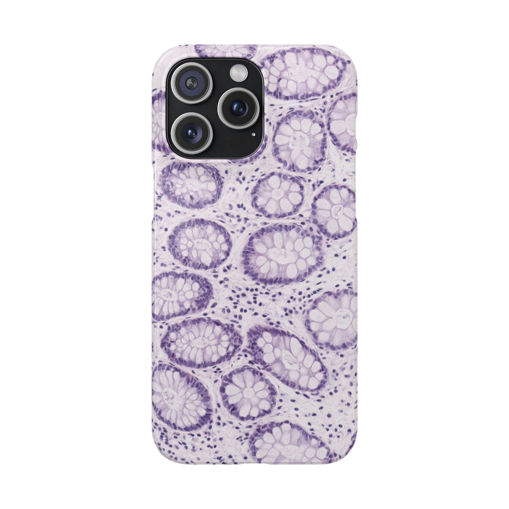 Slim Case Kolon