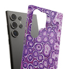 Slim Case Peutz-Jeghers Polyp