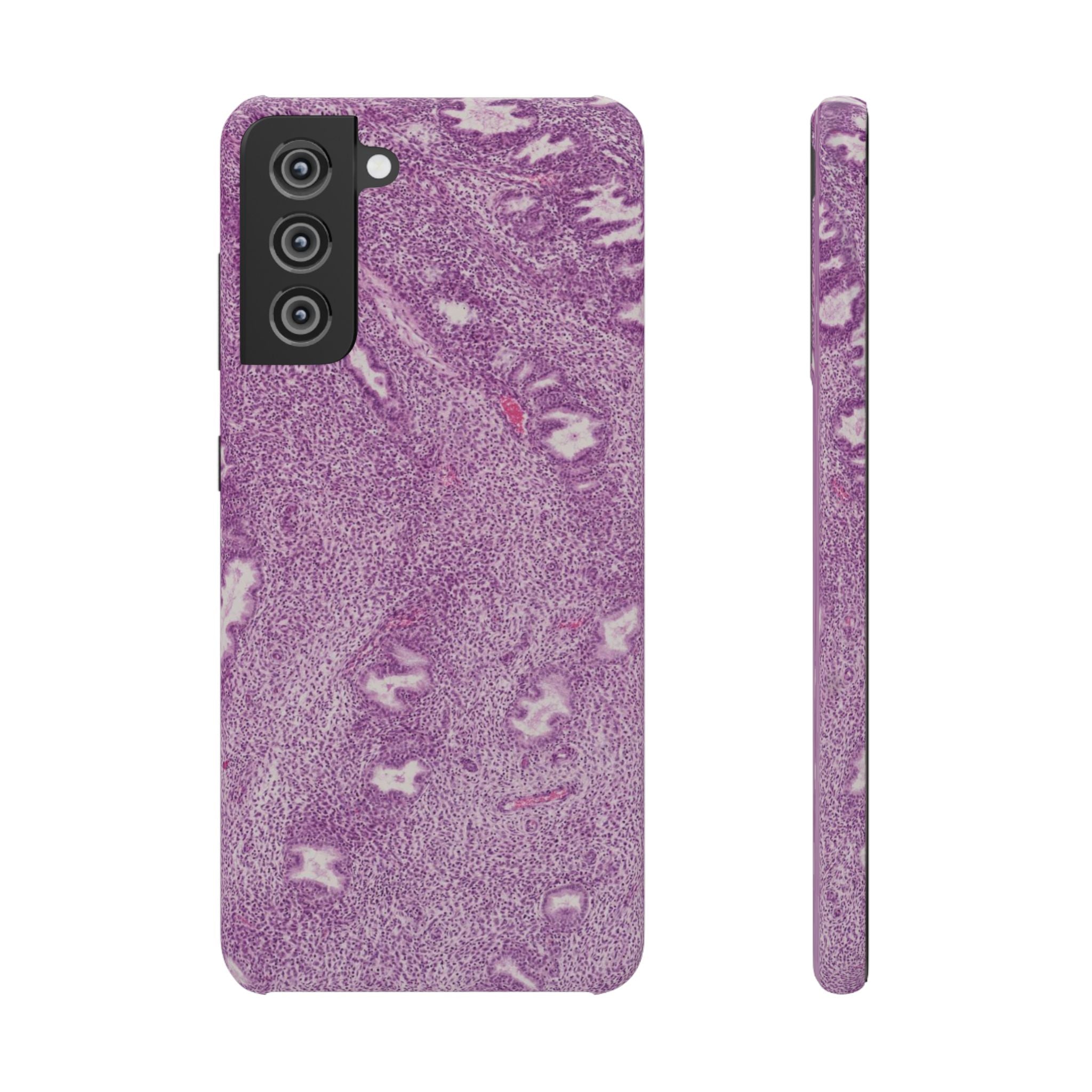 Slim Case Endometrium