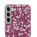 Slim Case Myelolipom