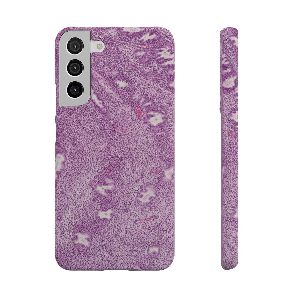 Slim Case Endometrium
