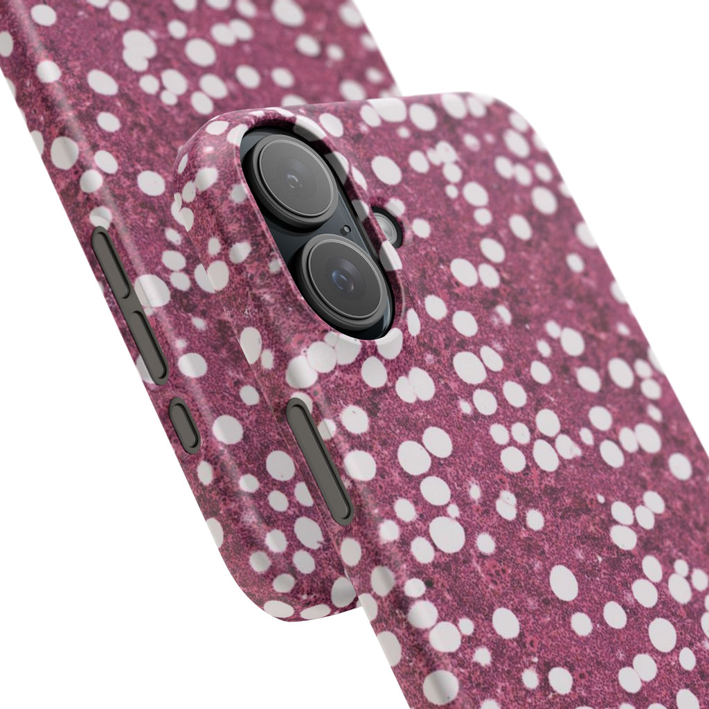 Slim Case Myelolipom