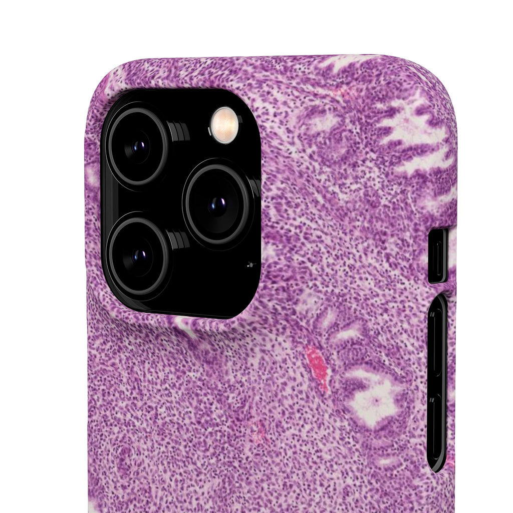 Slim Case Endometrium