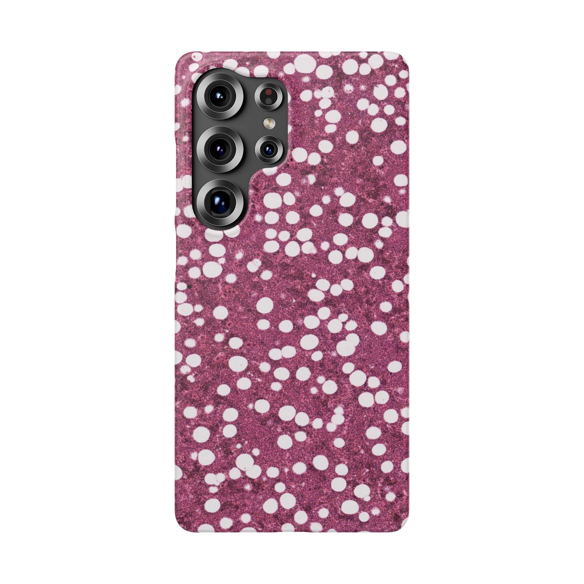 Slim Case Myelolipom