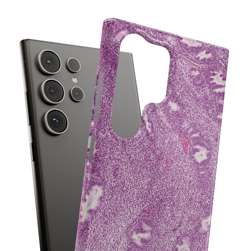Slim Case Endometrium