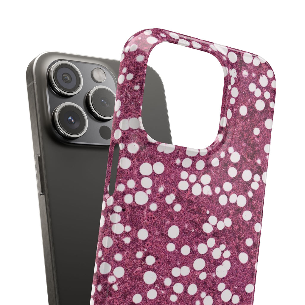 Slim Case Myelolipom