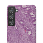 Slim Case Endometrium