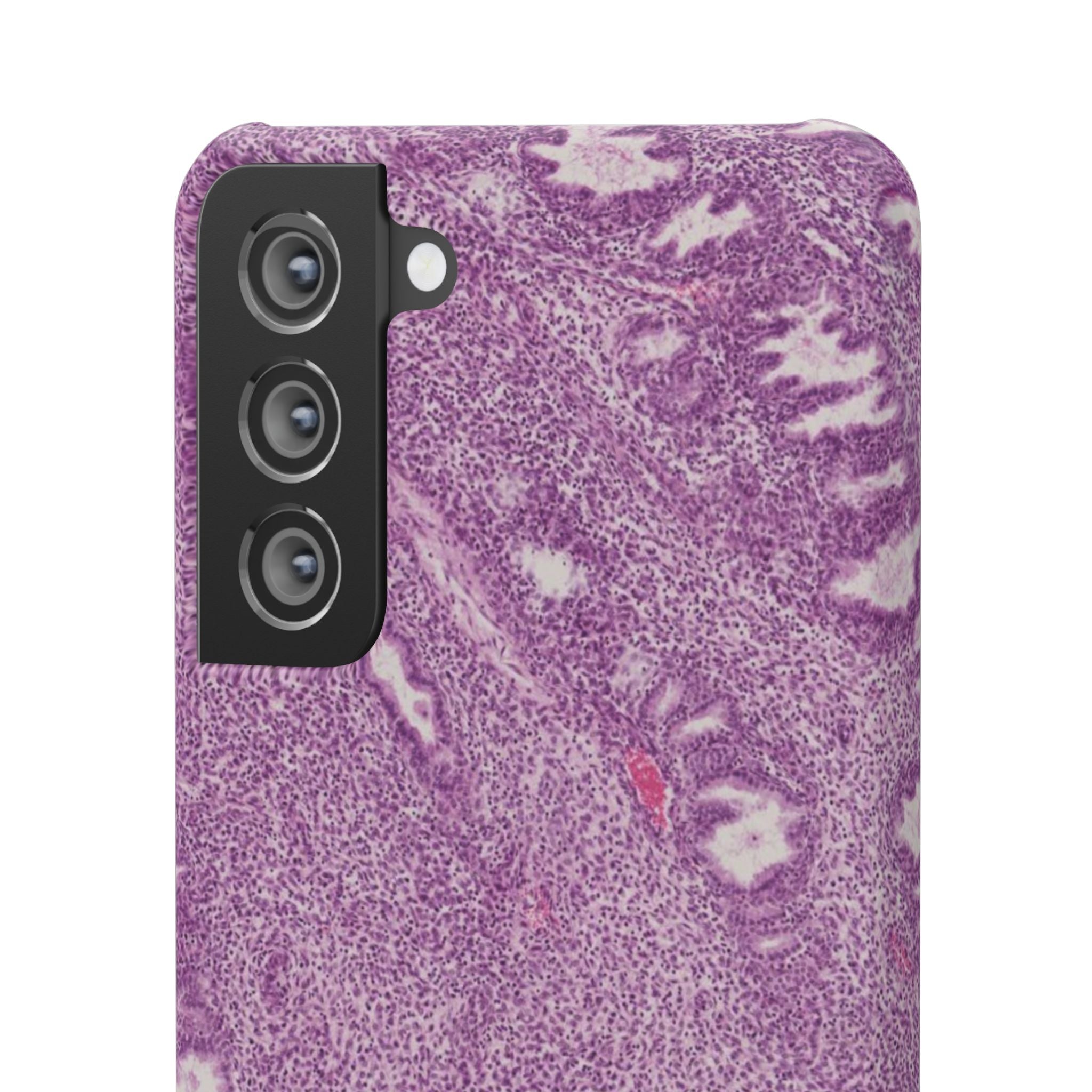 Slim Case Endometrium