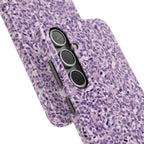 Slim Case Paraganglion