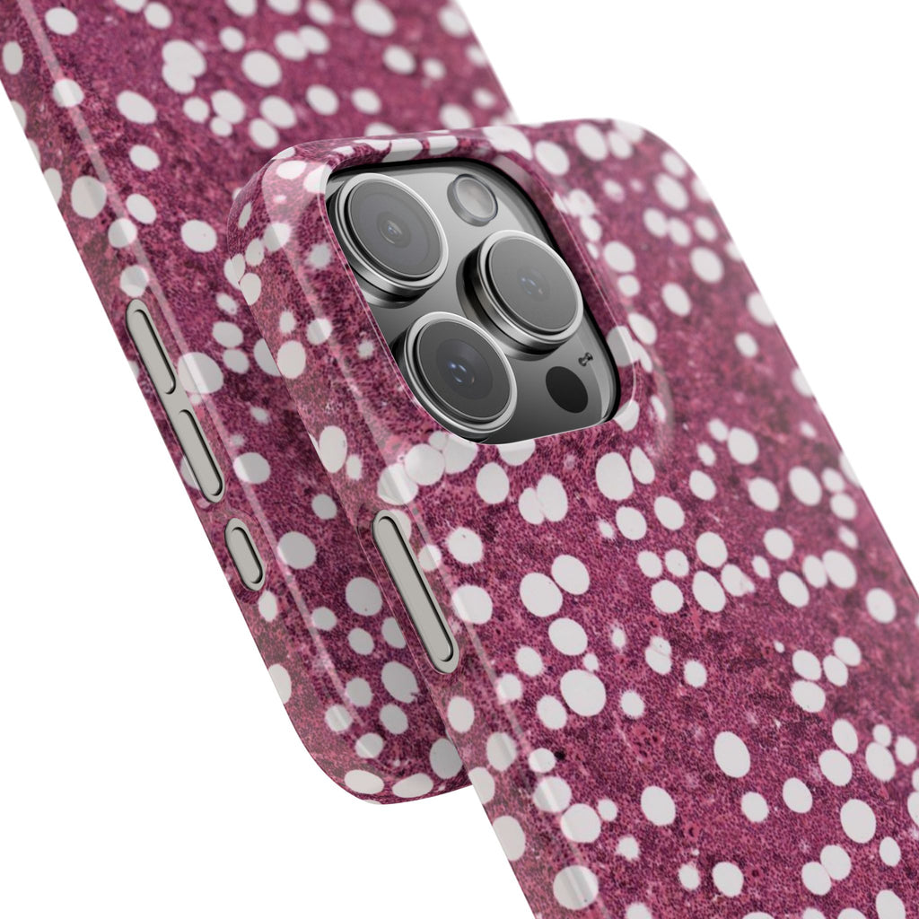 Slim Case Myelolipom