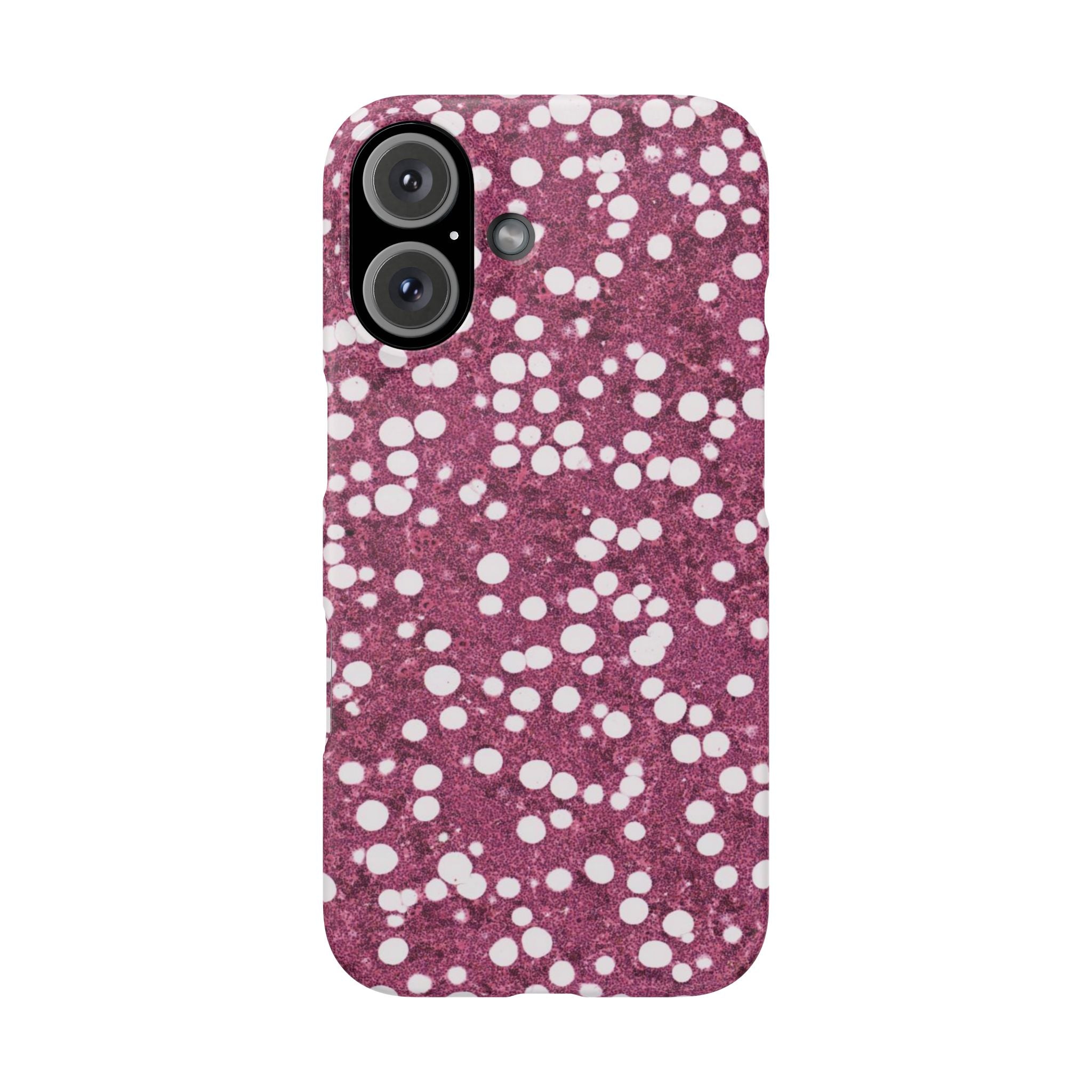 Slim Case Myelolipom